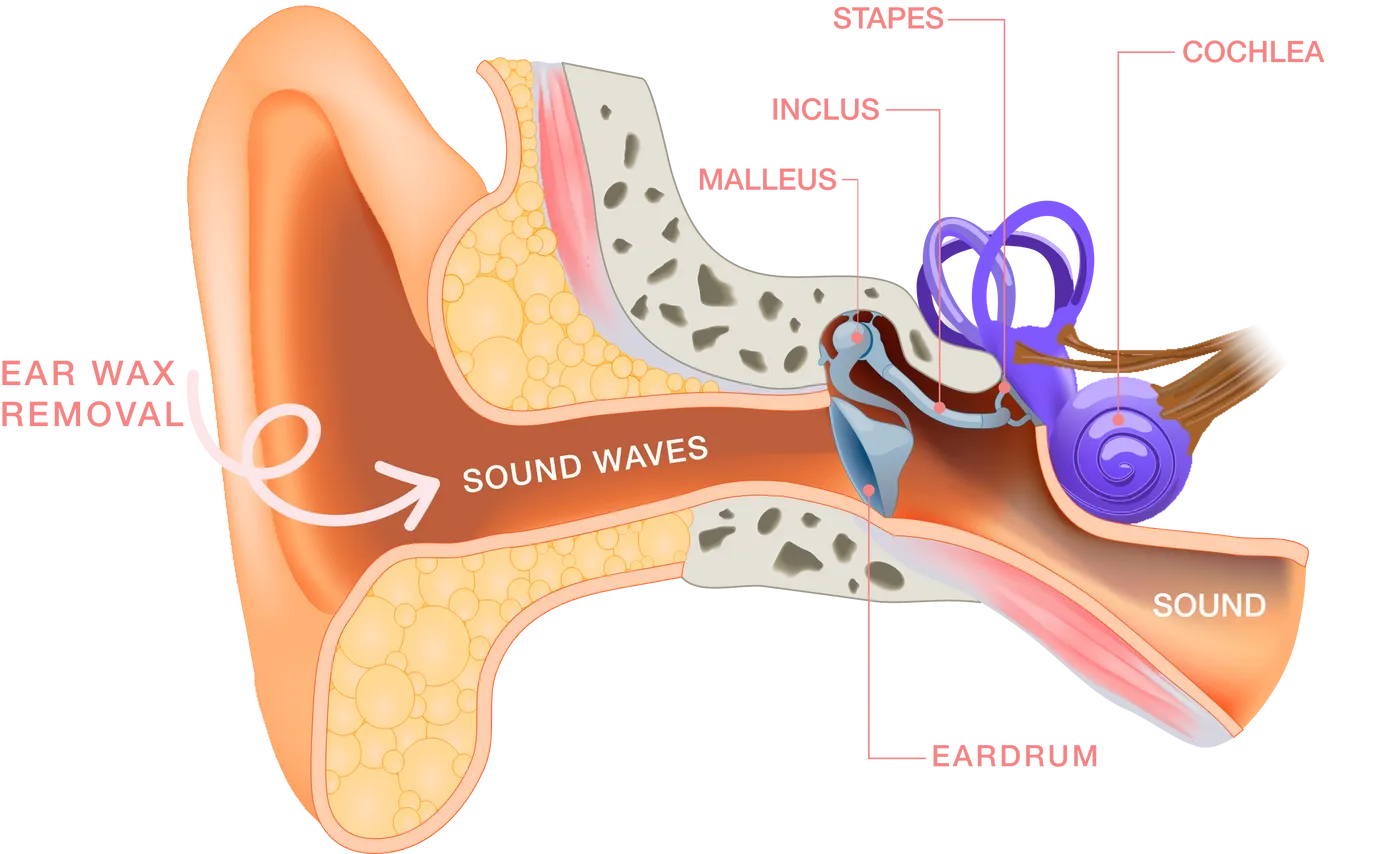 Schema ear wax removal